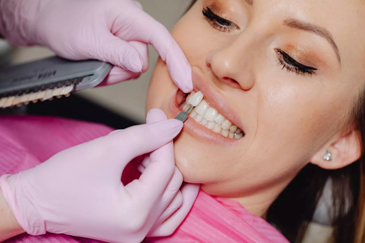 Veneers aus Keramik – dünne, ästhetische Verblendschalen für ein natürlich schönes Lächeln in der ACC Zahnklinik Basel