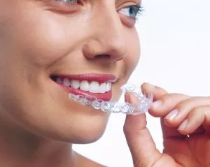 Invisalign und Aligner-Therapie – moderne, transparente Zahnkorrektur ohne feste Spangen in der ACC Zahnklinik Basel